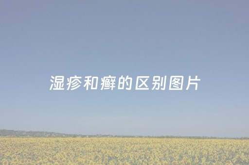 湿疹和癣的区别图片（湿疹和癣的区别图片对称的是什么）